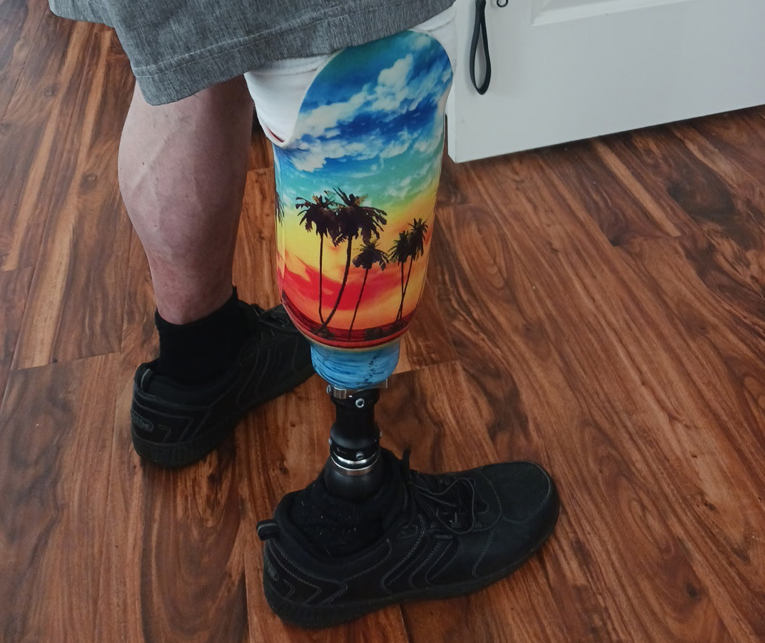 I lost my leg OCT 2022. Yes that's my real prosthetic. That's a conversation we can have JUST ASK! — Bobby O'Connor Jr.